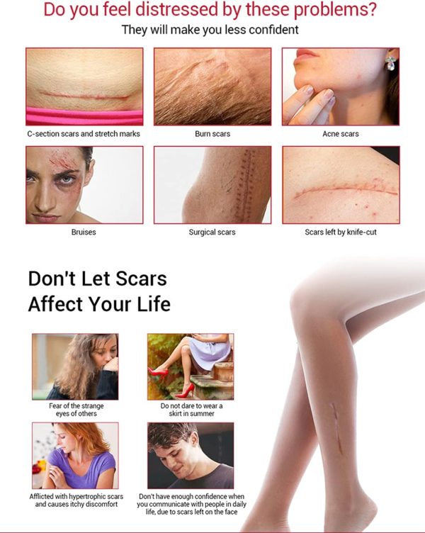 Aichun Beauty Scar Removal Serum with Kojic Acid and Vitamin E for Scars, Pimples, Stretch Marks 30ml