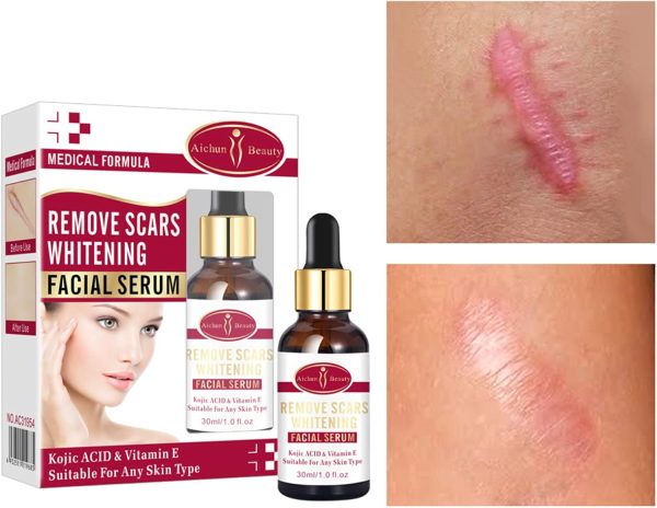 Aichun Beauty Scar Removal Serum with Kojic Acid and Vitamin E for Scars, Pimples, Stretch Marks 30ml