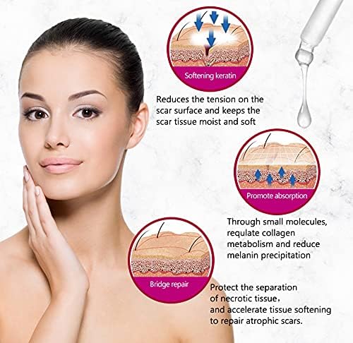 Aichun Beauty Scar Removal Serum with Kojic Acid and Vitamin E for Scars, Pimples, Stretch Marks 30ml